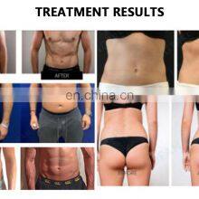 Abs Stimulator Fitness Electric Muscle Stimulation With Infrared Therapy Muscle Stimulator Machine Butt thumbnail-5