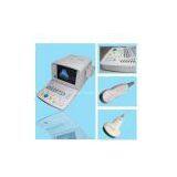 Portable Ultrasound Scanner----CE Approved Ultrasound Machine thumbnail-1