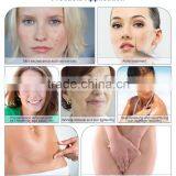 Skin Whitening MSLCF02A Factory Direct Best Price Fractional Co2 Wart Removal Laser Equipment Co2 Laser Scar Removal Face Whitening Vascular Lesions Removal thumbnail-2