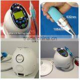 Q-switch Laser ND YAG for Tattoo Removal thumbnail-1