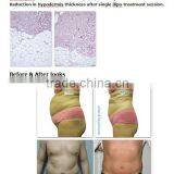 The Newest Portable Lipo Laser Weight Lose Machine for Home Use Beauty Spa With CE Approved thumbnail-2