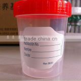 120ml sterile urine collection cups