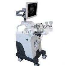 Portable Medical Ultrasound Instruments 15 Inch B/W Full- Digital 2D Ultrasound Trolley Ultrasound Scanner Machine thumbnail-2