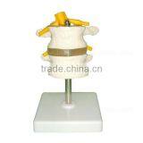 Human Body Anatomy Spine Model Lumbar Vertebra thumbnail-2