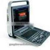 Loptop Fully Digital Ultrasound Scanner Ultrasound Scanner Color Doppler thumbnail-3