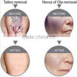 Super Fast Color Touch Screen Logo Customized 10HZ Laser Tattoo Removal Machine Equipment thumbnail-6