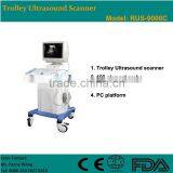 CE Approved PC Full Digital Trolley Ultrasound Scanner/ Ultrasound Machine With 3.5Mhz Multi-frequency Convex Probe RUS-9000C thumbnail-1
