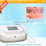 Spider Veins Removal Machine for Red Blood Silk Removal,angeioma Removal thumbnail-2