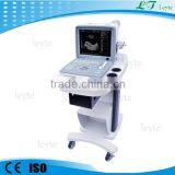 LTS-4 CE Medical Ultrasound Diagnosis Ultrasound Scan Machine