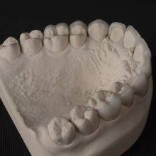 Digital-Crowns-Bridges Dental Laboratory in China thumbnail-4