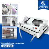 2016 New Style Laser Treatment Unit With Latest Invention 808nm Diode Laser Hair Removel Machine thumbnail-5