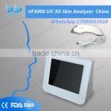 Skin Analyzer Machine Complete Set UV 3D Factory Manufacturers Supplier CESkin Analyzer Approval 3D Skin Analyzer VF5000 thumbnail-2