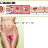 Manufacture Supply Professional Glass or RF Pipe 10600nm 40w Fractional Co2 Laser Acne Scar Removal thumbnail-5