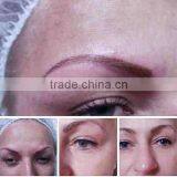 532nm Sanhe Beauty Super Tattoo Removal Machine Q Vascular Tumours Treatment Switch ND YAG Laser/ Face Lifting Machines thumbnail-4