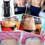 Supersonic Operation System and Weight Loss Feature Weight Loss Electronic Machine/ultrasound RF Lipo Laser thumbnail-3