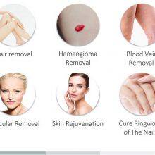 Long-pulsed Nd YAG Laser 1064nm for Hair Removal in Dark Skin 755nm Alex Laser for Hair Removal in White Skin thumbnail-4