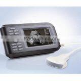 2016 New Handheld Ultrasound Scanner Palm Ultrasound Machine thumbnail-6