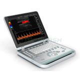 AG-BU005 Laptop Handheld Medical Color Doppler System Mobile Ultrasound Scanner