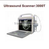 Wholesale Portable Digital High Quality Ultrasound Scanner thumbnail-1