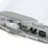 15-inch Laptop Ultrasound Scanner With Multi-frequency Probes thumbnail-3