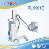 Portable analogue X ray system 100mA radiography PLX101C