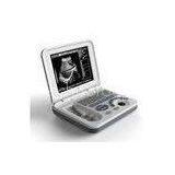 Laptop Ultrasound Scanner Biomedical 3000K 10