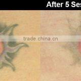 Hot Sale Q Switched Nd Yag Laser Tattoo 800mj Removal Nd Yag Laser Tattoo Removal Machine 1064nm thumbnail-5