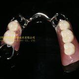 Dental Co-Cr Partial Denture,Titanium Framework Denture, Dental Dentures, Laboratoire Dentaire, Dentallabor, Laboratorio Dental, Dental Laboratory, Shenzhen LJ Dental Lab China thumbnail-4
