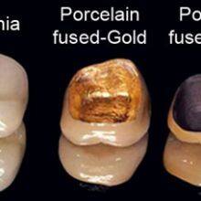 Clear Aligner Lab From China Orthodontics Lab From China thumbnail-5