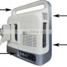 Hot Selling Medical Cheapest-portable-ultrasound-machine for Hospital and Clinic Use thumbnail-2
