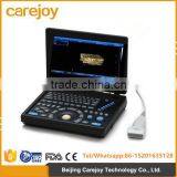 Laptop Ultrasound Scanner With 3D Function thumbnail-1