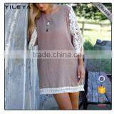 Lace Design Half Sleeve Dress,shift Dresses,casual Shift Dresses thumbnail-4