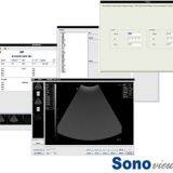 Top Quality 3D B/W Doppler Sonoview Machine Trolley Ultrasound Scanner thumbnail-3