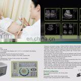 MY-A001A Laptop Full Digital Portable Ultrasound Scanner Mini Ultrasound Machine thumbnail-2