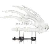 CE & ISO Marked Mini Fragment External Fixator (Finger and Palm) Surgical Instrument thumbnail-4