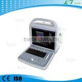 LTV580 Portable Doppler Color Ultrasound Scanning Machine