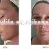 NL-RFC200 Portable Multi-functional RF/monopolar rf Skin Rejuvenation Machine /monopolar rf Skin Care Machine thumbnail-6