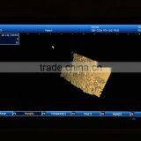 CE &FDA Approved 3D Laptop Veterinary Ultraaouns Machine thumbnail-3