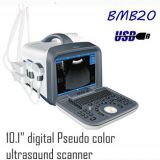 10.1 inch full digital Pseudo color ultrasound scanner
