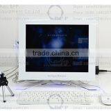 Gynecology Video Colposcope For Hospital thumbnail-2