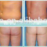 We Need Distributors 4 Handles OSANO Body Shape Vaser Liposuction Machine For Sale thumbnail-6