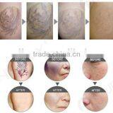 Best Q-switched Nd: Yag Laser thumbnail-5