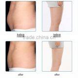 3 Applicators Body Slimming Cryo Fat Freeze Machines thumbnail-5