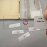 Lab and Medical Pathology Histology Microscope Slides thumbnail-2