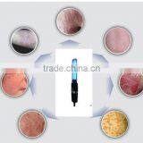 1xPL-S 9W/01 UVB 311nm Phototherapy for Psoriasis Vitiligo thumbnail-1