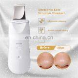 Ultrasonic Ion Skin Scrubber Facial Care Ultrasonic Scrubber Cleaner Blackhead Removal Face Peeling Extractor Skin Beauty Device thumbnail-2