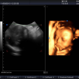 Премиумный 4D цветной допплеровский ультразвуковой сканер thumbnail-2