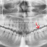 Dental X-ray Film, x Ray Film Green Sensitive, Digital x Ray Film thumbnail-1