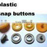 10.12.15mm Plastic Snaps