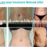 New Mini Diode Lipo Laser Slimming Weight Loss Machine Lipo Diode Laser Slimming Machine for Home Use thumbnail-3